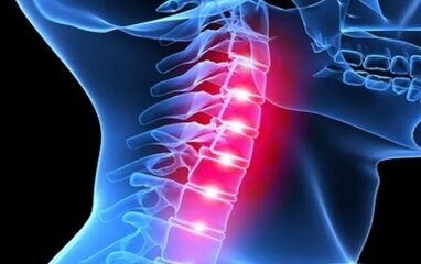 Symptoms of cervical column osteochondrosis