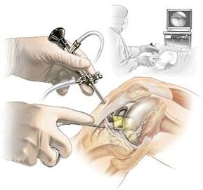 Clarification of the diagnosis of osteoarthritis in dashboard medicine